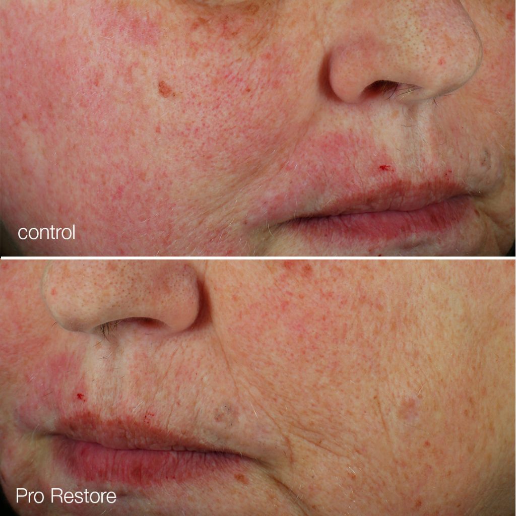 Instagram post from dermalogica.med.il. This post is in position 1.