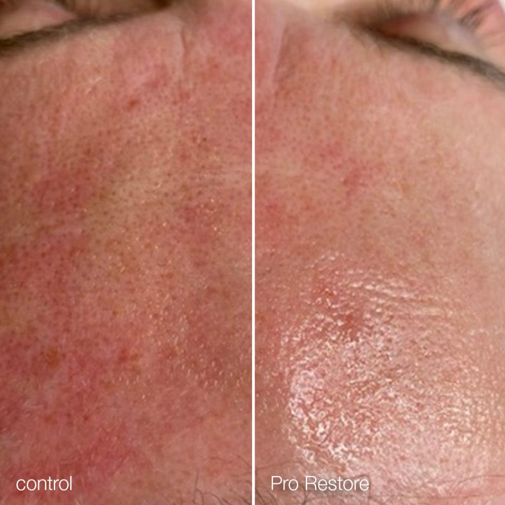 Instagram post from dermalogica.med.il. This post is in position 2.