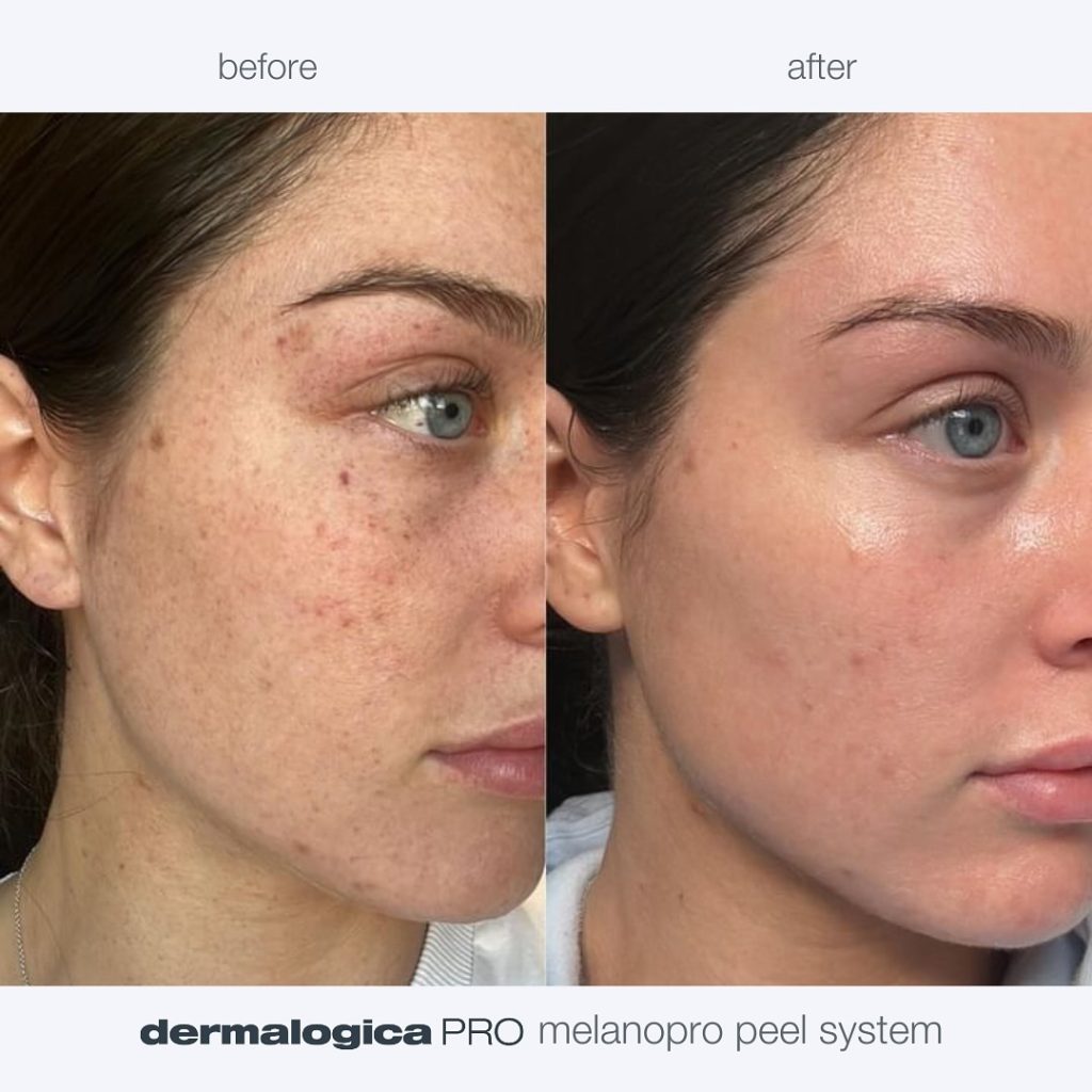 Instagram post from dermalogica.med.il. This post is in position 1.