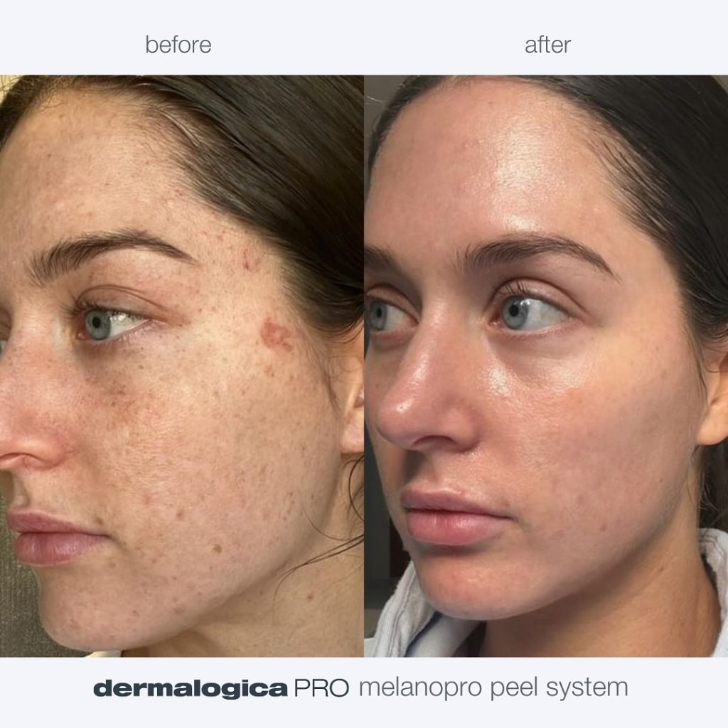 Instagram post from dermalogica.med.il. This post is in position 0.